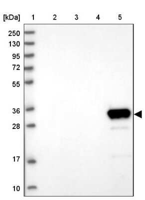 Western Blot: GLYATL1 Antibody [NBP2-48708]