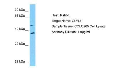 Western Blot: GLYATL1 Antibody [NBP2-84985]