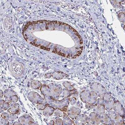 Immunohistochemistry-Paraffin: GLYATL2 Antibody [NBP2-32526]