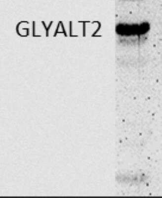 Western Blot: GLYATL2 Antibody [NBP2-32526]