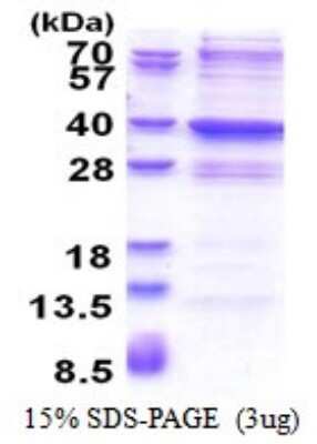 SDS-PAGE: Recombinant Human GLYATL2 His Protein [NBP2-51566]