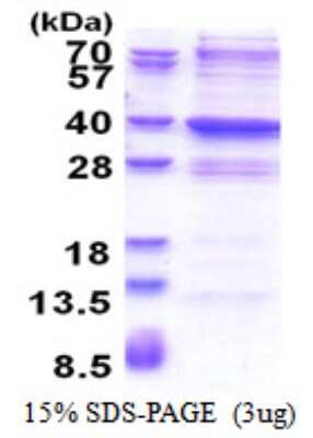 SDS-PAGE: Recombinant Human GLYATL2 His Protein [NBP2-51566]