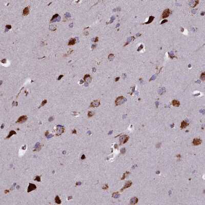 Immunohistochemistry-Paraffin: GLYATL3 Antibody [NBP1-91947]