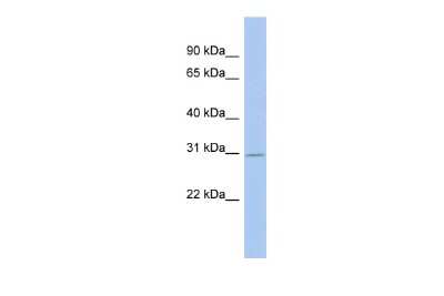 Western Blot: GLYATL3 Antibody [NBP2-84986]