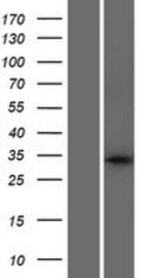 Western Blot: GLYATL3 Overexpression Lysate [NBP2-09133]