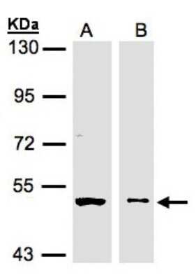 Western Blot: GLYCTK Antibody [NBP1-32317]