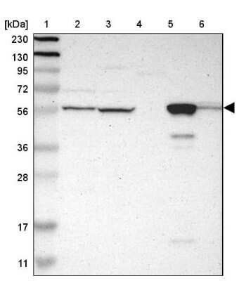 Western Blot: GLYCTK Antibody [NBP1-83292]