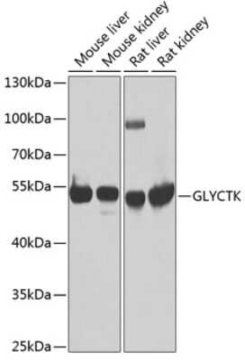 Western Blot: GLYCTK AntibodyBSA Free [NBP3-04925]