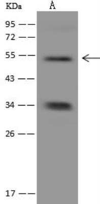 Western Blot: GLYCTK Antibody [NBP3-12587]