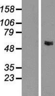 Western Blot: GLYCTK Overexpression Lysate [NBP2-05491]