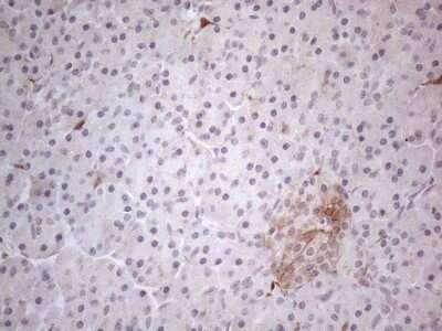 Immunohistochemistry: GM-CSF Antibody (OTI8G5) [NBP2-46364]