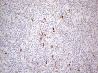 Immunohistochemistry: GM-CSF Antibody (OTI8G5) [NBP2-46364]