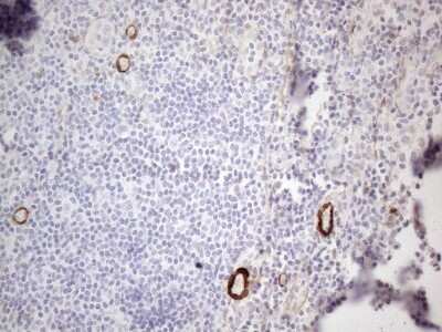 Immunohistochemistry: GM-CSF Antibody (OTI8G5) [NBP2-46364]
