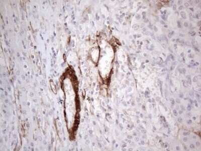 Immunohistochemistry: GM-CSF Antibody (OTI8G5) - Azide and BSA Free [NBP2-70462]