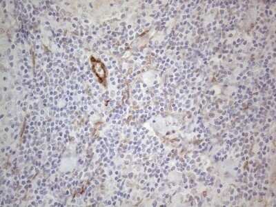 Immunohistochemistry: GM-CSF Antibody (OTI8G5) - Azide and BSA Free [NBP2-70462]