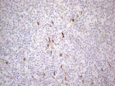 Immunohistochemistry: GM-CSF Antibody (OTI8G5) - Azide and BSA Free [NBP2-70462]