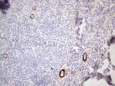 Immunohistochemistry: GM-CSF Antibody (OTI8G5) - Azide and BSA Free [NBP2-70462]
