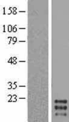 Western Blot: GM-CSF Overexpression Lysate [NBL1-09515]