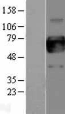 Western Blot: GM-CSFR alpha Overexpression Lysate [NBP2-04432]