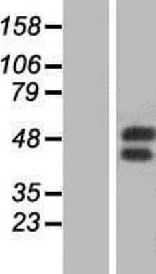 Western Blot: GM-CSFR alpha Overexpression Lysate [NBP2-11303]