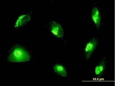 Immunocytochemistry/ Immunofluorescence: GM130/GOLGA2 Antibody [H00002801-B02P]