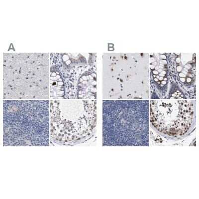 Immunohistochemistry-Paraffin: GM130/GOLGA2 Antibody [NBP1-89756]