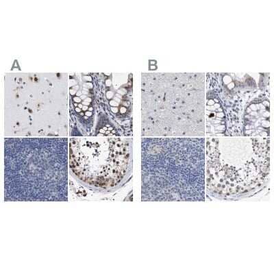 Immunohistochemistry-Paraffin: GM130/GOLGA2 Antibody [NBP1-89758]