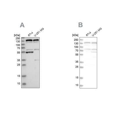 Western Blot: GM130/GOLGA2 Antibody [NBP1-89756]