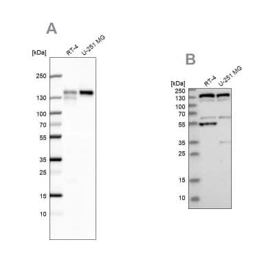 Western Blot: GM130/GOLGA2 Antibody [NBP1-89757]