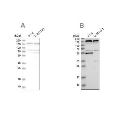 Western Blot: GM130/GOLGA2 Antibody [NBP1-89758]