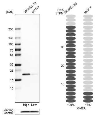 Western Blot: GM2A Antibody [NBP1-87090]