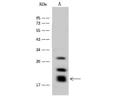 Western Blot: GM2A Antibody [NBP3-00106]