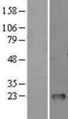 Western Blot: GM2A Overexpression Lysate [NBL1-11135]