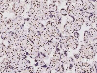 Immunohistochemistry: GM632 Antibody [NBP2-98091]