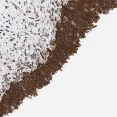 Immunohistochemistry-Paraffin: GM632 Antibody [NBP1-91948]