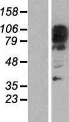 Western Blot: GM632 Overexpression Lysate [NBP2-06616]