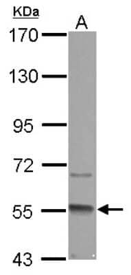 Western Blot: GMCL1 Antibody [NBP2-16693]