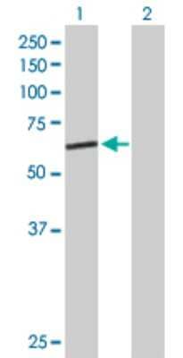 Western Blot: GMCL1L Antibody [H00064396-B01P]