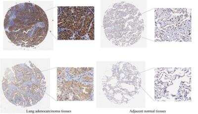 Immunohistochemistry: GMDS Antibody [NBP1-33424]