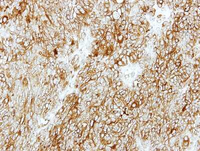 Immunohistochemistry-Paraffin: GMDS Antibody [NBP1-33424]