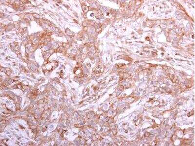 Immunohistochemistry-Paraffin: GMDS Antibody [NBP1-33424]