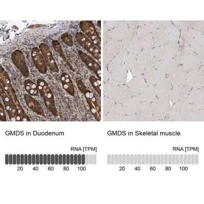 Immunohistochemistry-Paraffin: GMDS Antibody [NBP1-83357]