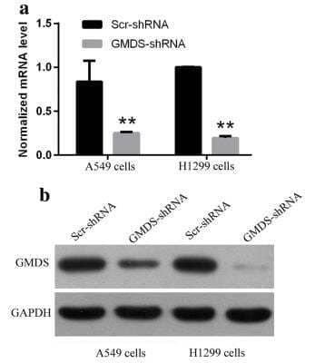 Knockdown Validated: GMDS Antibody [NBP1-33424]