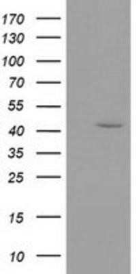 Western Blot: GMDS Antibody (OTI2A1)Azide and BSA Free [NBP2-70835]