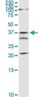 Western Blot: GMDS Antibody [H00002762-D01P]