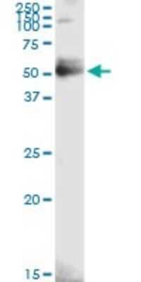 Western Blot: GMDS Antibody [H00002762-D01P]