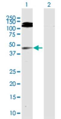 Western Blot: GMDS Antibody [H00002762-D01P]