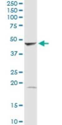 Western Blot: GMDS Antibody [H00002762-D02P]