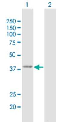 Western Blot: GMDS Antibody [H00002762-D02P]