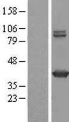 Western Blot: GMDS Overexpression Lysate [NBL1-11137]